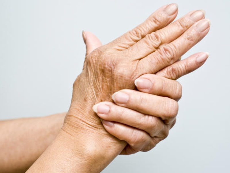 Artrosis: En qué consiste y cuáles son sus síntomas